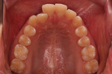 사직동교정치과