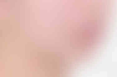 부산사랑니교정