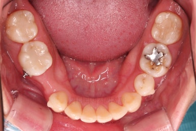 부산인비절라인