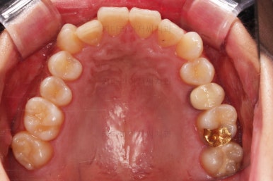 연산동교정치과