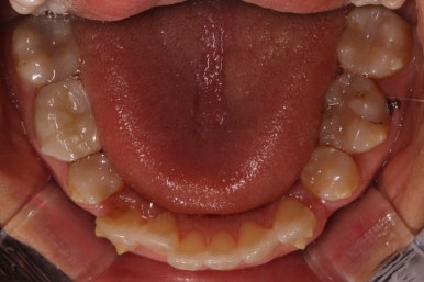 부산인비절라인