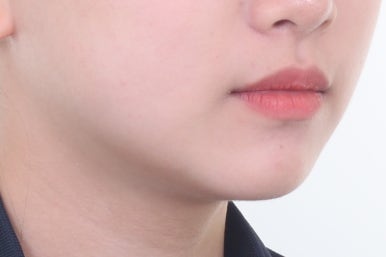 부산치아교정잘하는곳