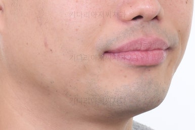 부산교정치과추천