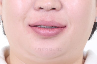 부산교정치과