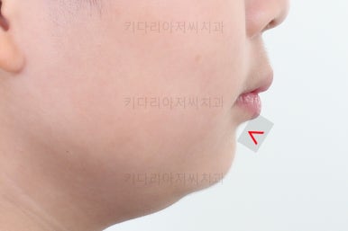 부산어린이교정