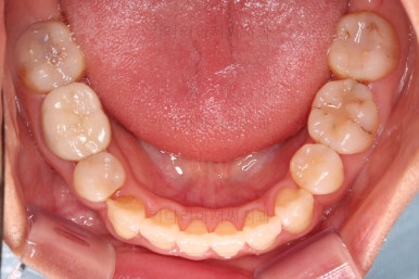 부산인비절라인