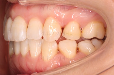 부산인비절라인