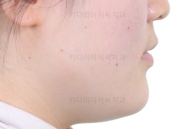 부산치아교정