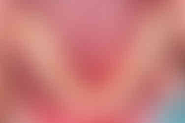 부산구순구개열교정