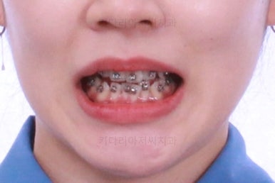 부산교정