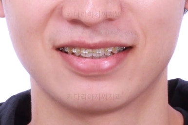 부산연제구교정