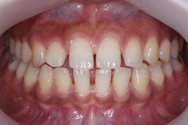 부산치아교정치과