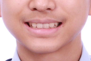 부산교정치과추천