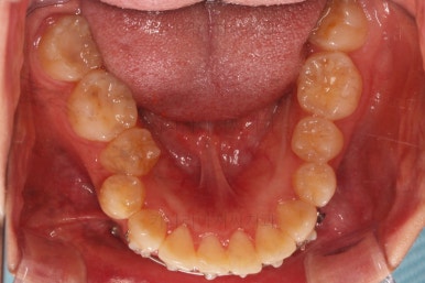 부산무턱교정치과