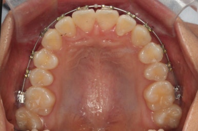 부산연산동청소년교정