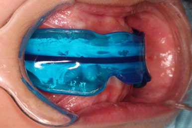 부산어린이교정