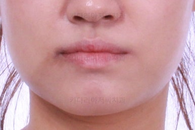 부산치아교정잘하는곳