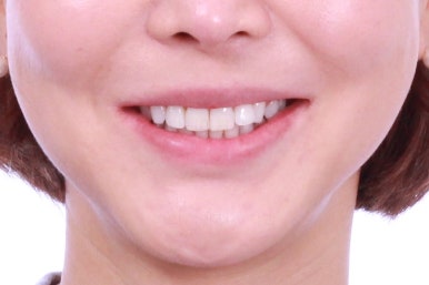 연산동부분교정