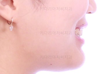 부산치아교정치과