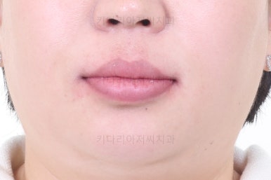 부산교정치과
