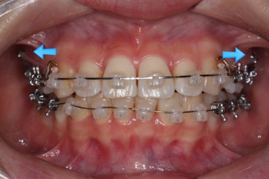 연산동교정치과