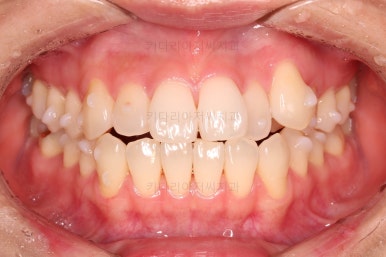 부산인비절라인