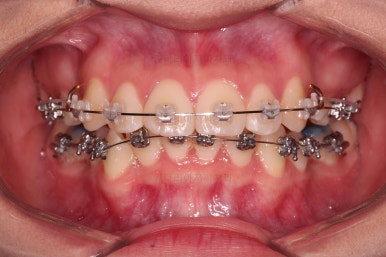 연산동치아교정치과