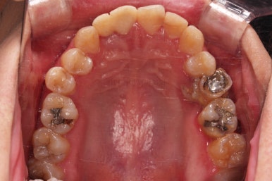 연산동치아교정