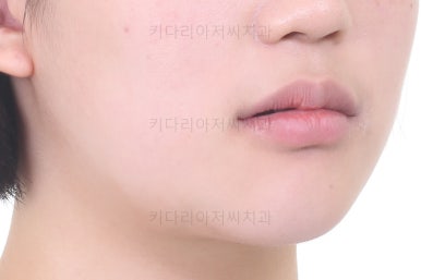 사직동교정치과