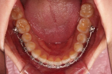 연산동교정치과