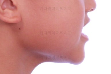 부산어린이교정
