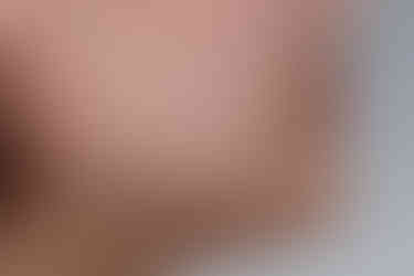 부산치아교정치과