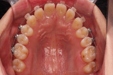 부산교정치과추천