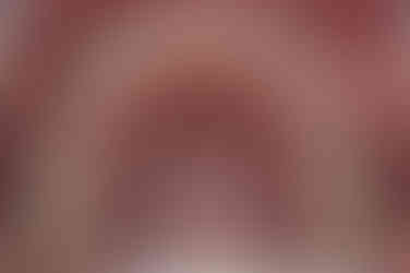 부산왜소치교정