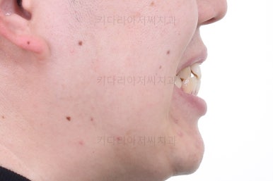 부산인비절라인