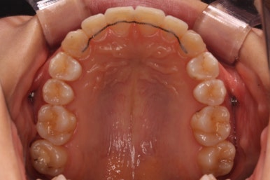 연산동교정치과