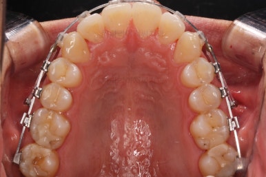 부산교정치과추천