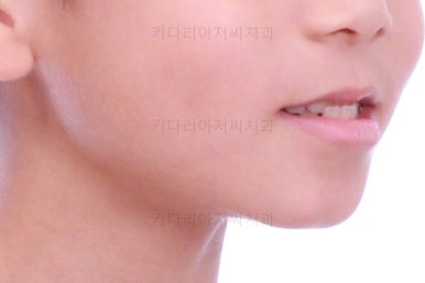 부산어린이교정