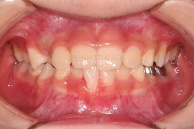 부산어린이교정