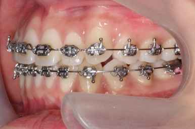 부산연산동청소년교정