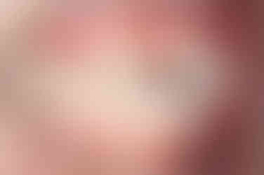 부산앞니부분교정