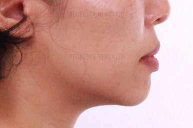 부산연산동교정치과