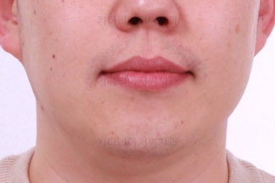 부산인비절라인