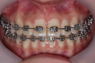 부산연산동청소년교정