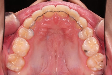 부산교정치과추천