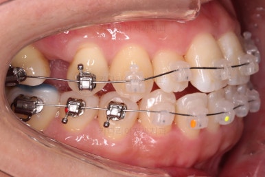 부산연산동치과