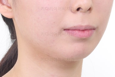 부산무턱교정치과