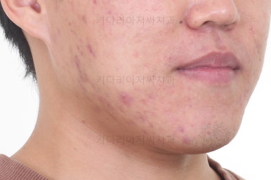 부산교정과전문의