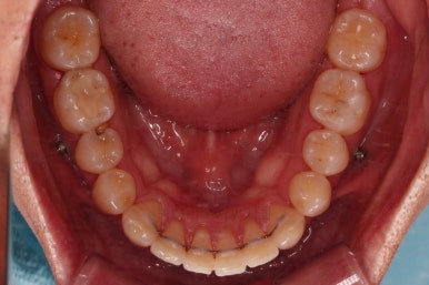 부산교정치과추천