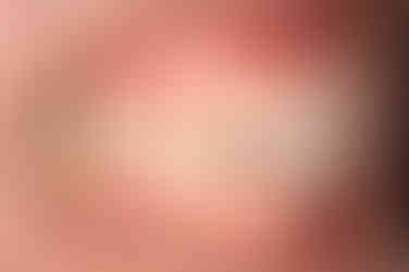 부산임플란트교정